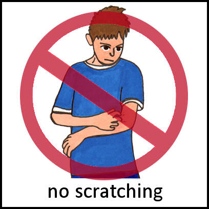 No Scratching